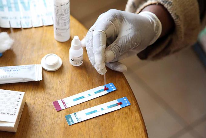 Ein Aidstest wird vorgenommen Ein Aidstest wird vorgenommen